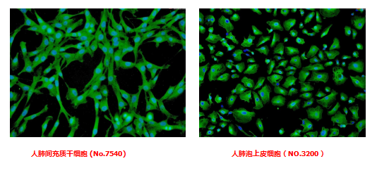 冠状病毒,检测试剂盒,干细胞,人肺微血管内皮细胞,内皮细胞,上皮细胞,原代细胞,人肺间充质干细胞