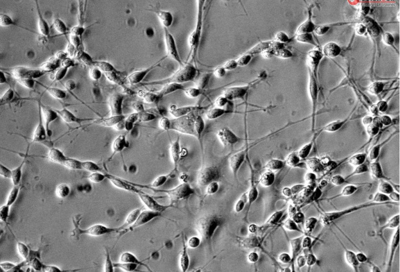 人少突胶质前体细胞