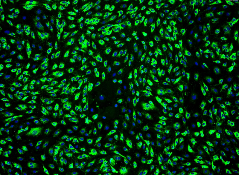 人真皮微血管内皮细胞-成人