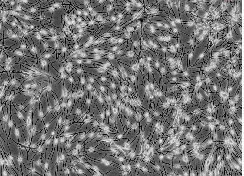 人表皮黑色素细胞--中色素