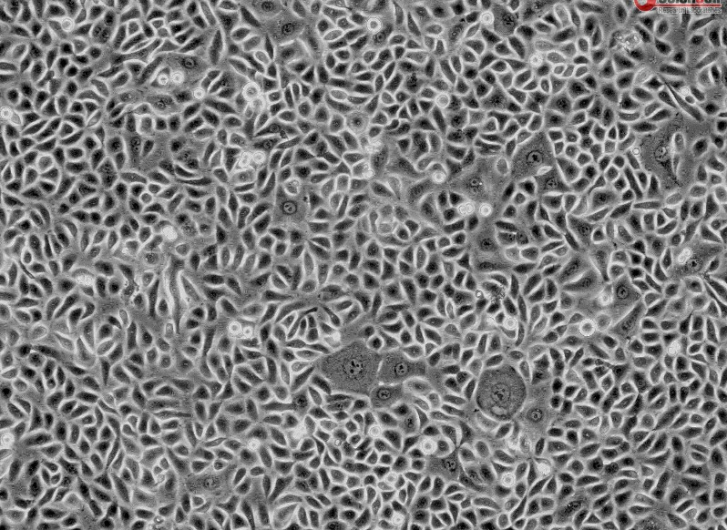 人支气管上皮细胞