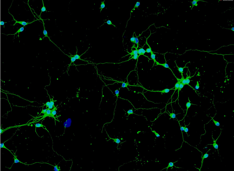 cd1小鼠海马趾神经元