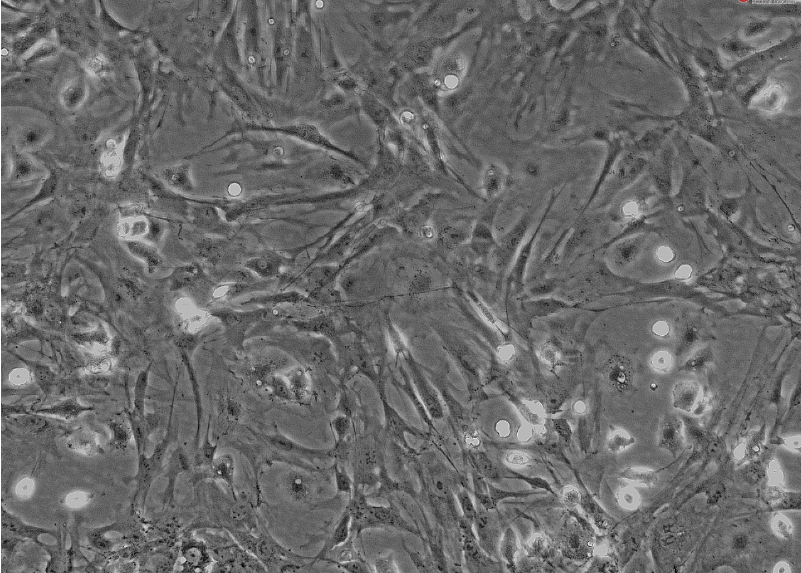 小鼠肝星状细胞