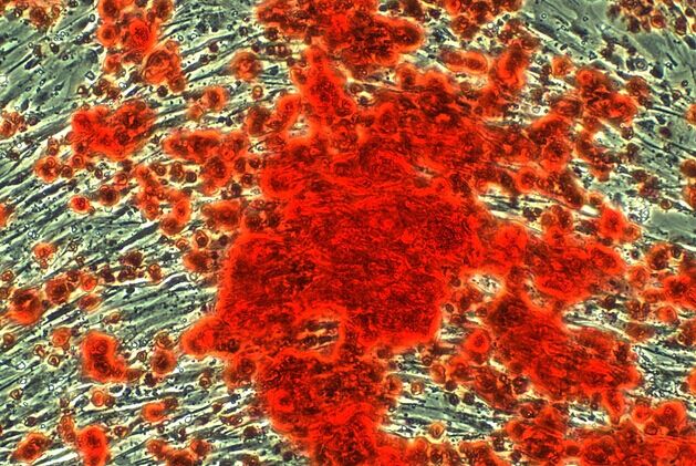 首页 > 产品中心               英文名:alizarin red s staining